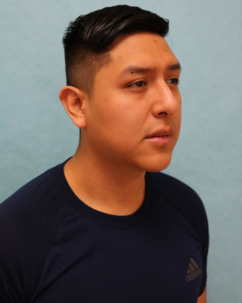 Chin Augmentation Before & After Gallery - Patient 799042 - Image 4
