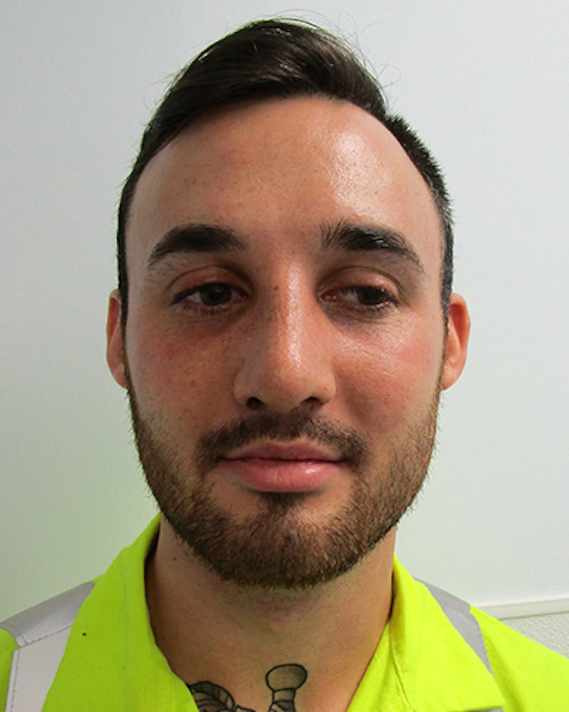 Rhinoplasty Before & After Gallery - Patient 118119 - Image 2