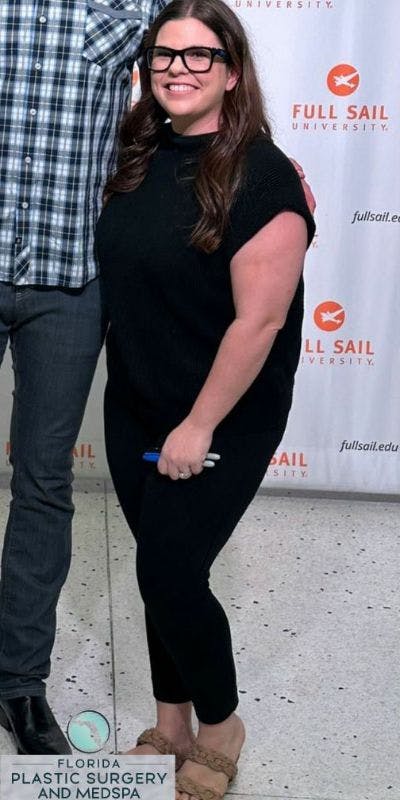 Weight Loss Before & After Gallery - Patient 345467 - Image 1