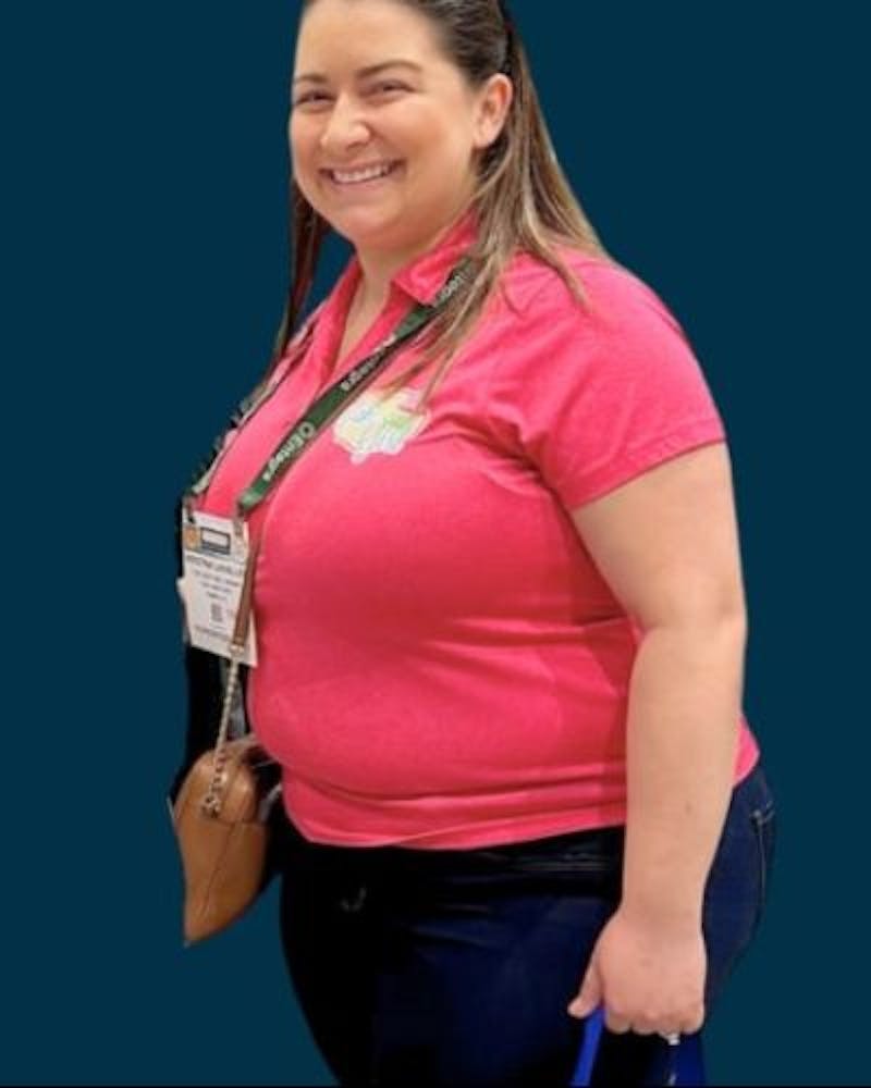 Weight Loss Before & After Gallery - Patient 372337 - Image 1