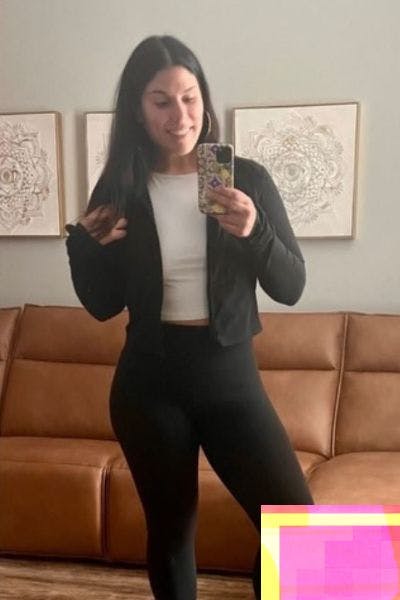 Weight Loss Before & After Gallery - Patient 255833 - Image 2