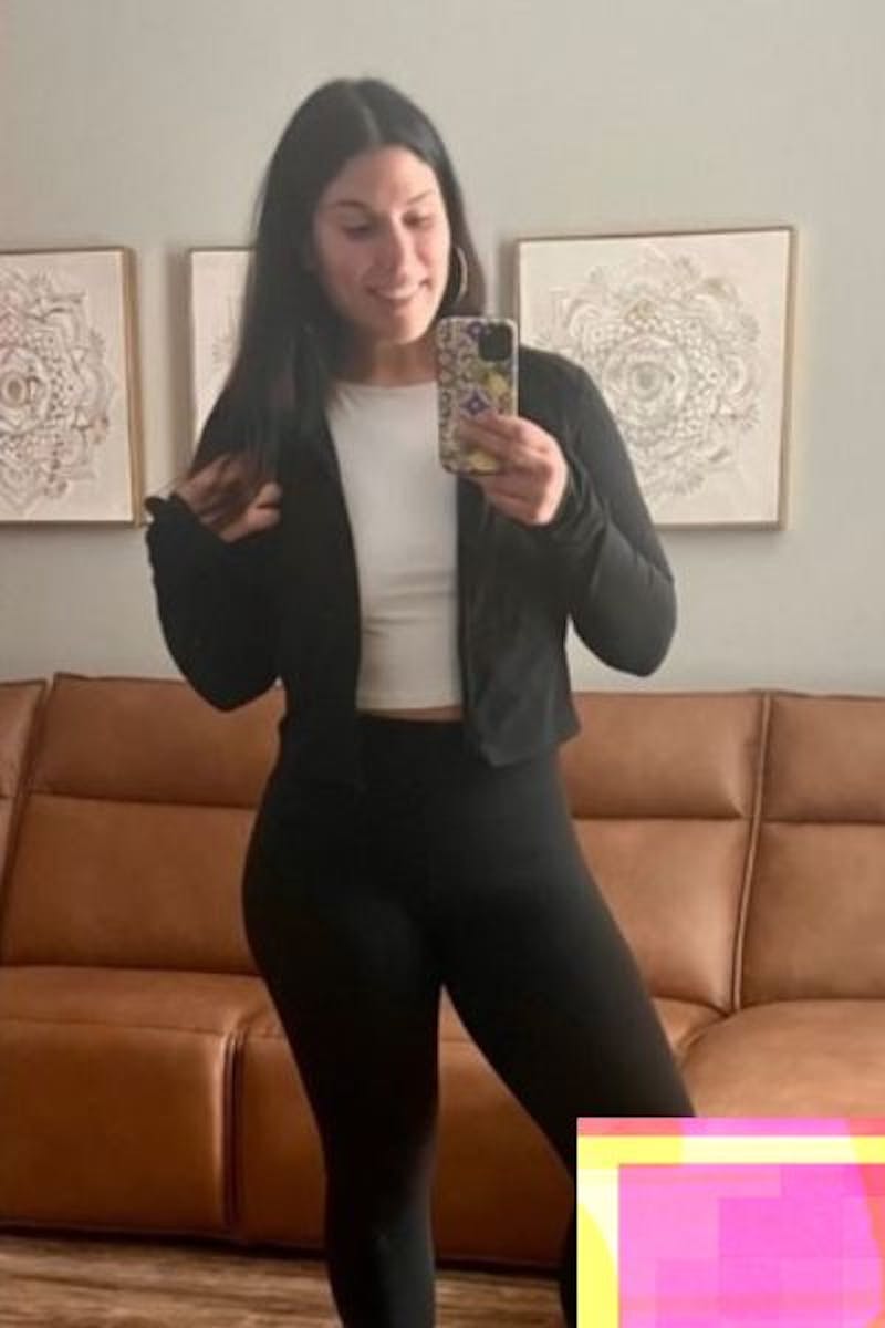 Weight Loss Before & After Gallery - Patient 255833 - Image 2