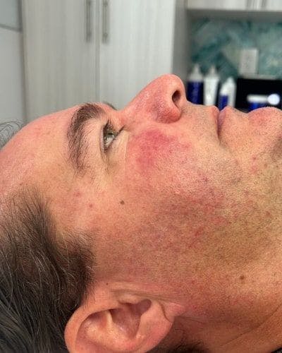 DiamondGlow Before & After Gallery - Patient 112514 - Image 1