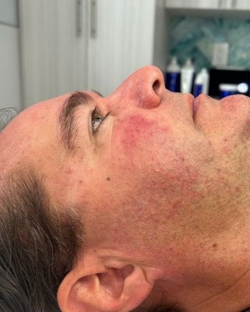 DiamondGlow Before & After Gallery - Patient 112514 - Image 1