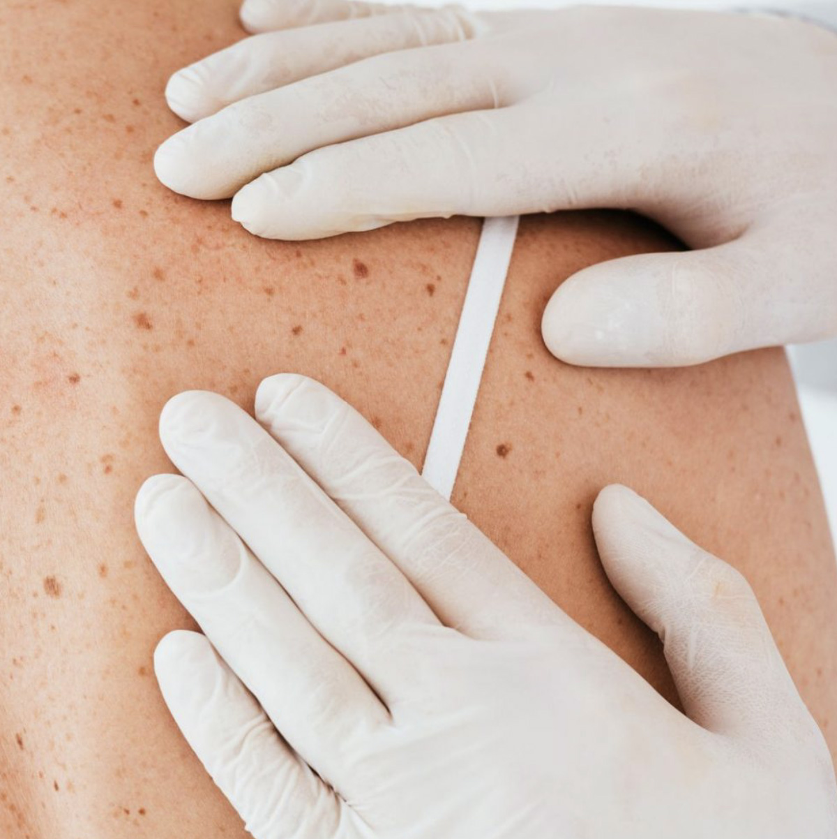 Medical Dermatology Care