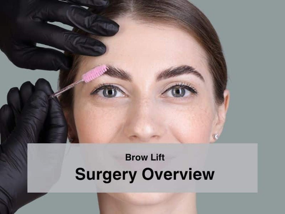 Brow Lift Surgery Overview
