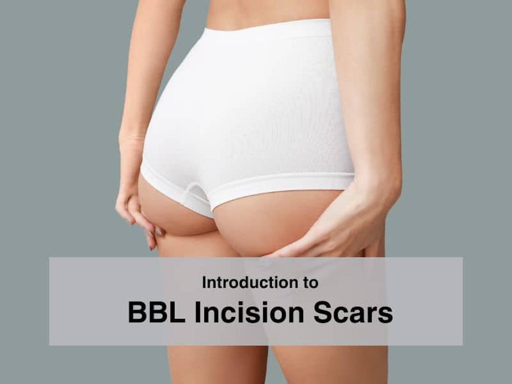 Introduction to BBL Incision Scars