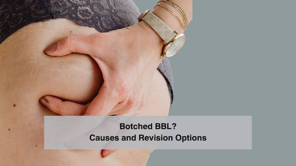 Botched BBL? Causes and Revision Options