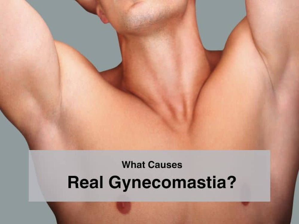 What Causes Real Gynecomastia