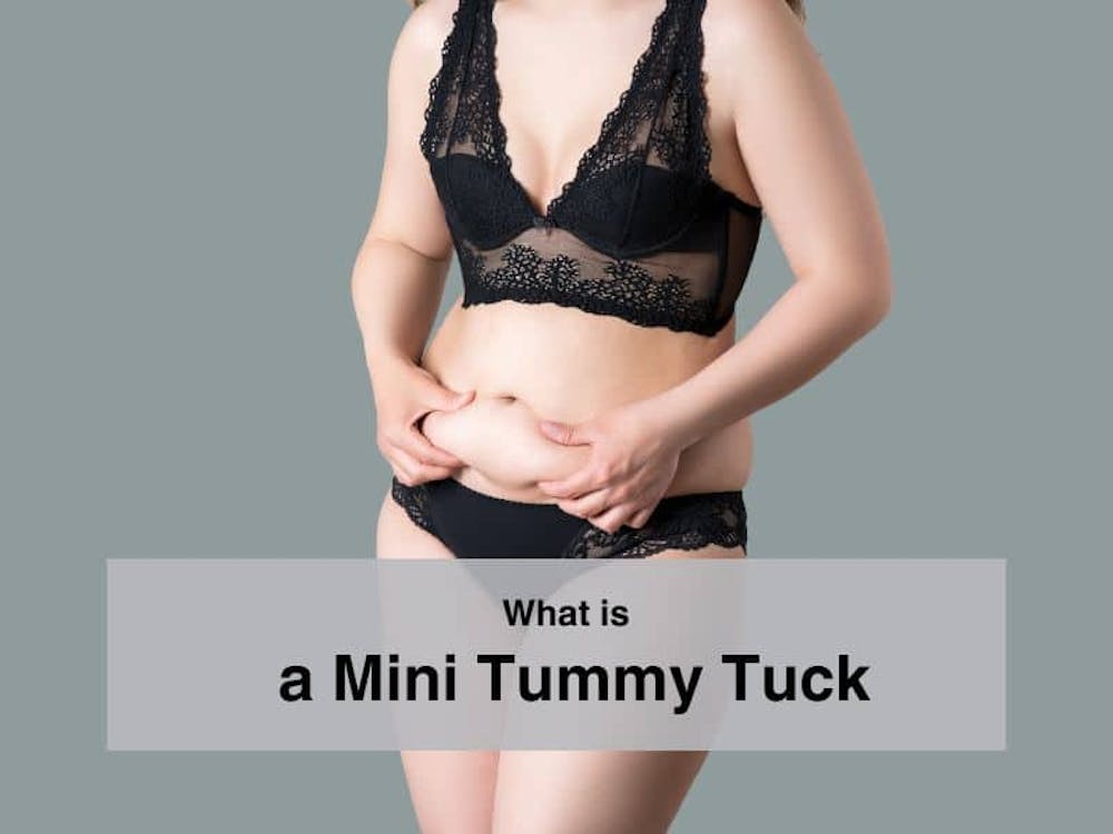 What is a Mini Tummy Tuck