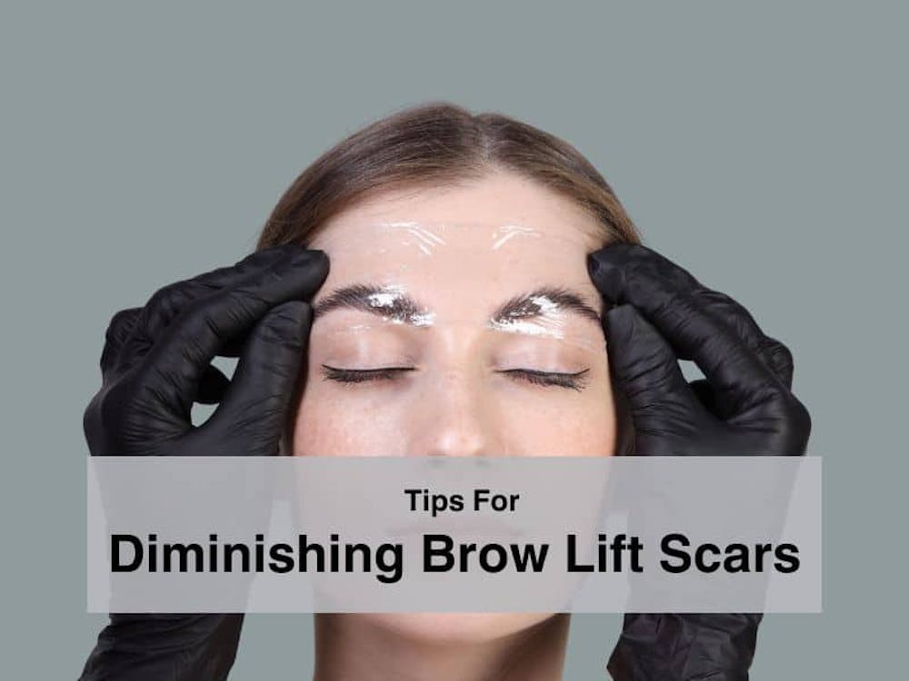 Tips Diminishing Brow Lift Scars