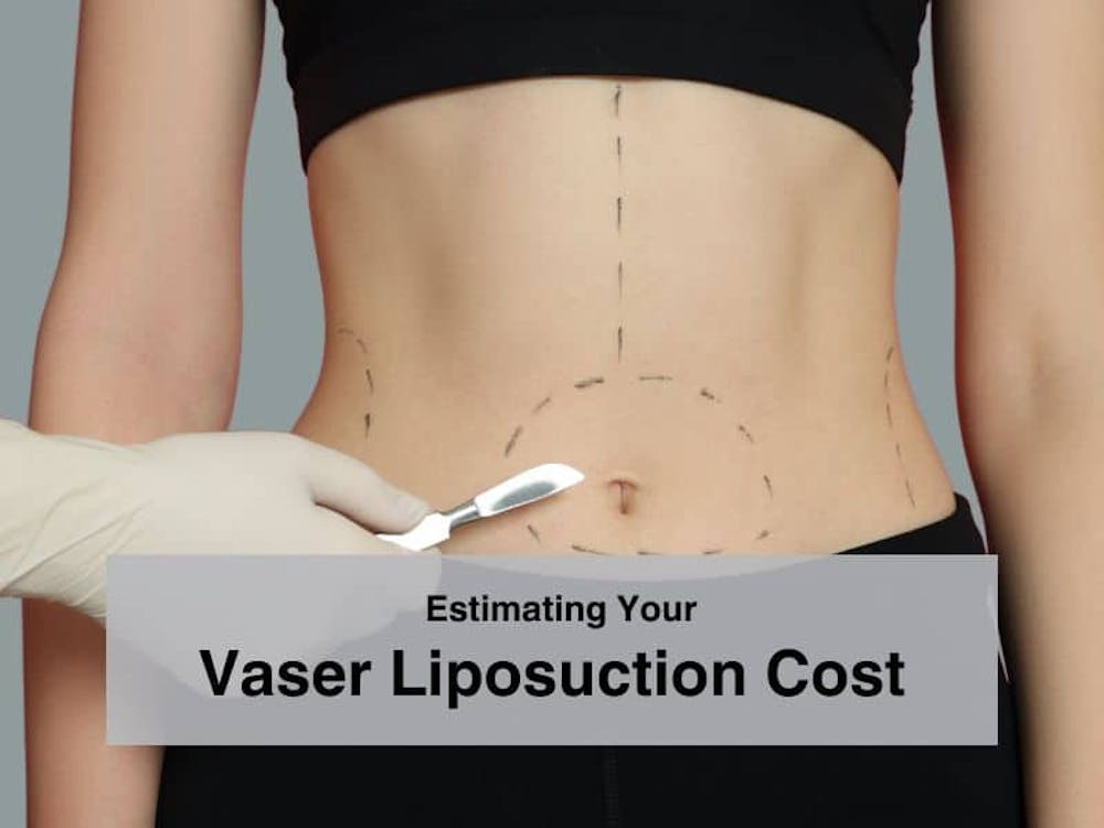 Estimating Your Vaser Liposuction Cost