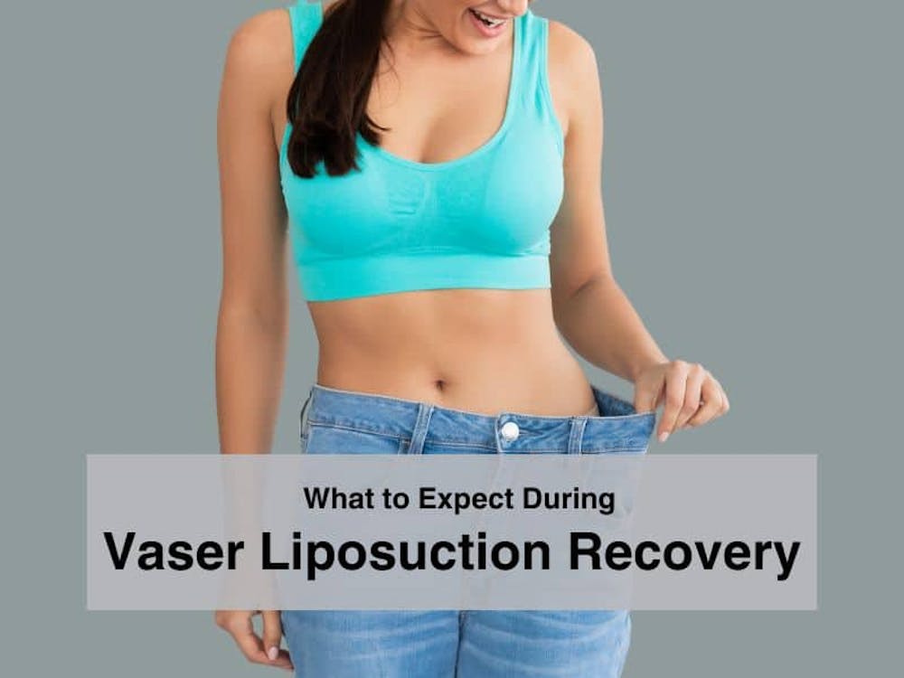 What to Expect During Vaser Liposuction Recovery