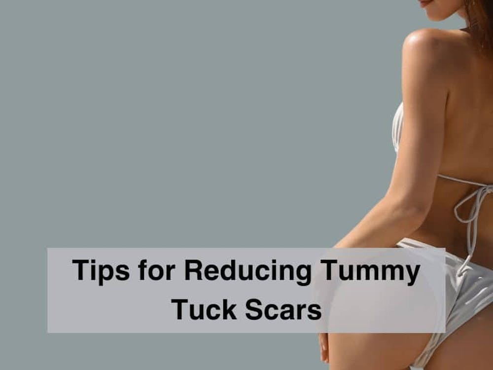 Tips for Reducing Tummy Tuck Scars