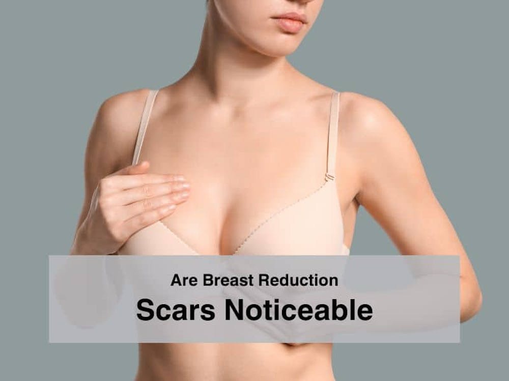 Are breast reduction scars noticeable
