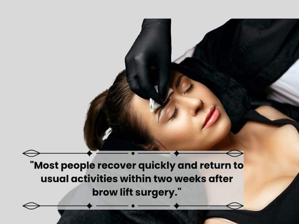 brow lift recovery Brow Lift Day by Day Recovery