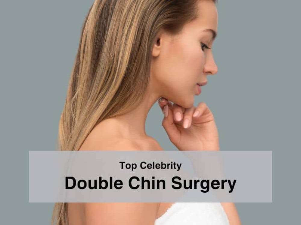 Top Celebrity Double Chin Surgery
