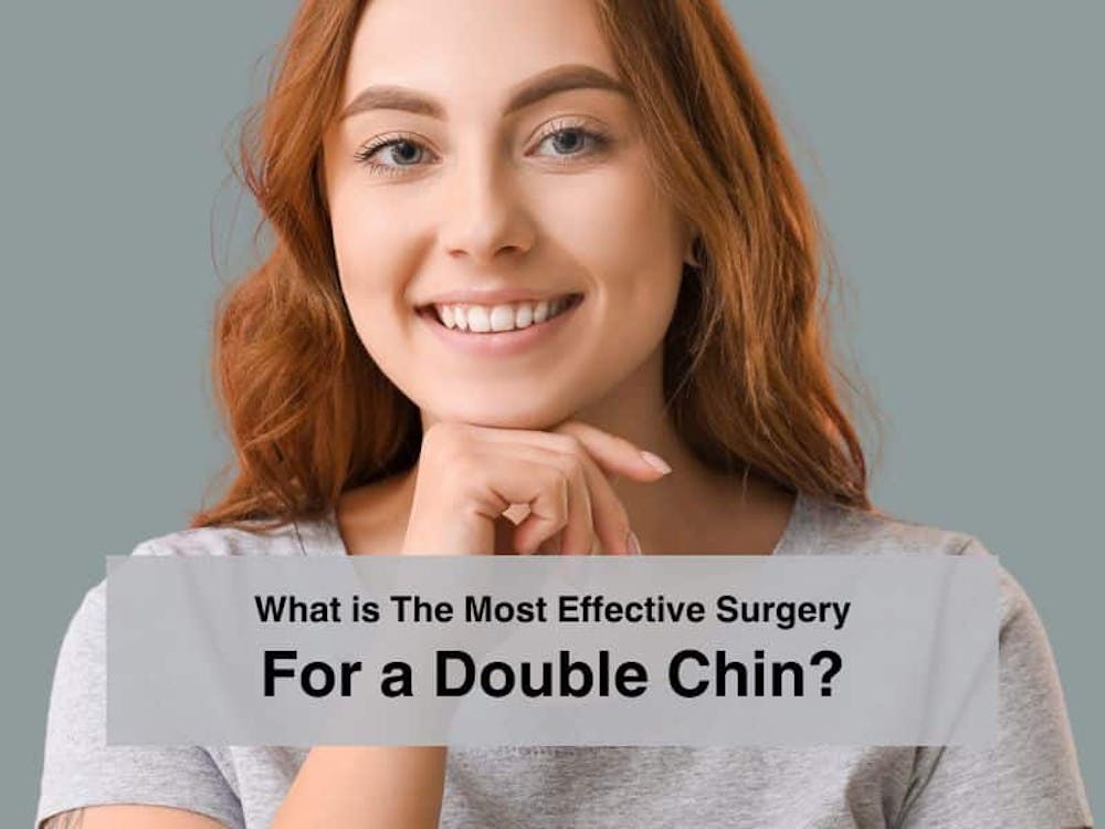 What is the most effective surgery for a double chin