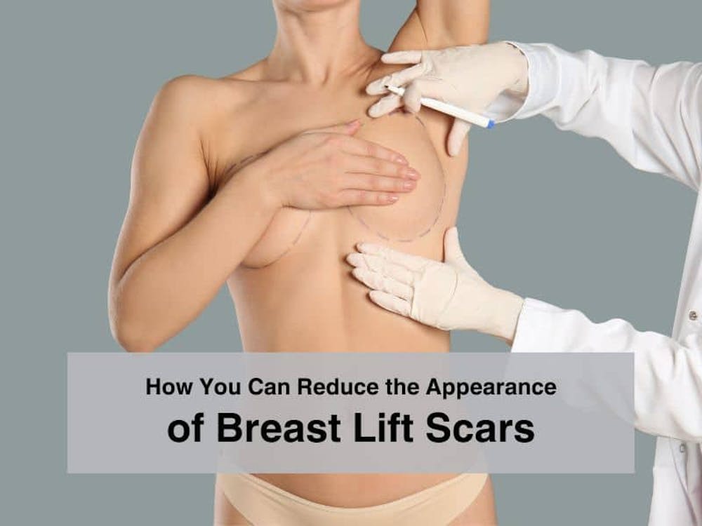 How You Can Reduce the Appearance of Breast Lift Scars