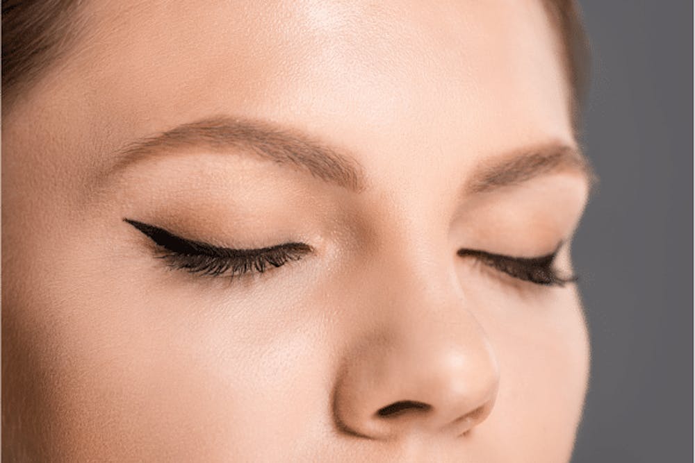 Before And After Eyelid Surgery