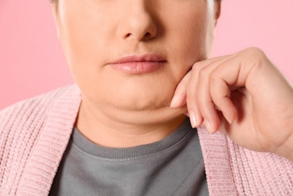 Chin liposuction recovery time