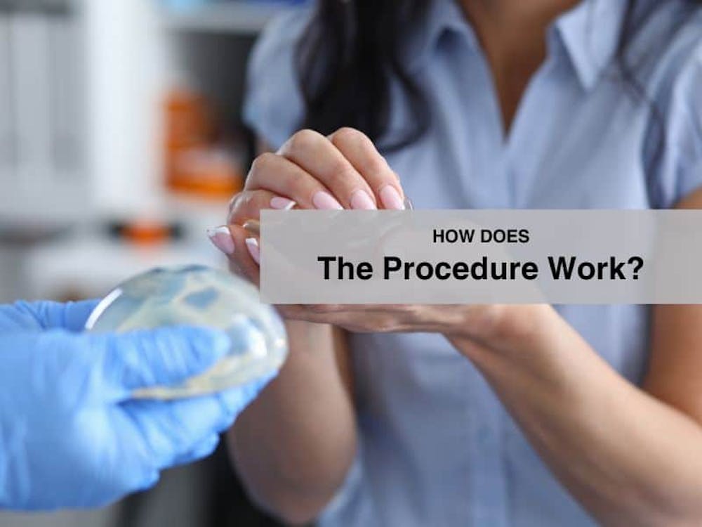 How Does The Procedure Work?