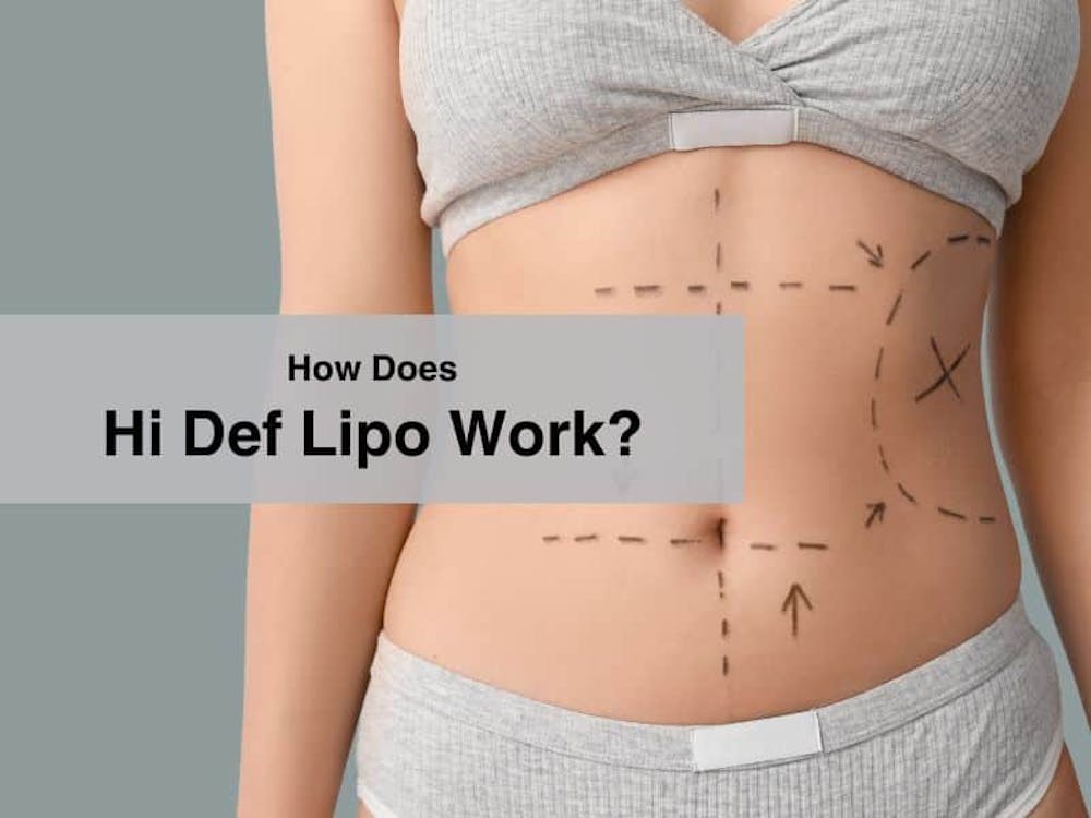 How Does Hi Def Lipo Work?