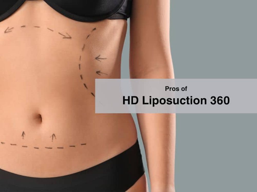 Pros of HD Liposuction 360
