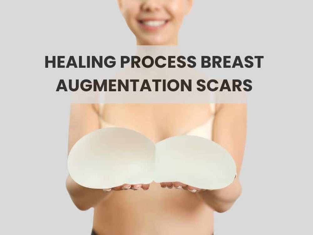 Healing Process Breast Augmentation Scars Healing Process Breast Augmentation Scars