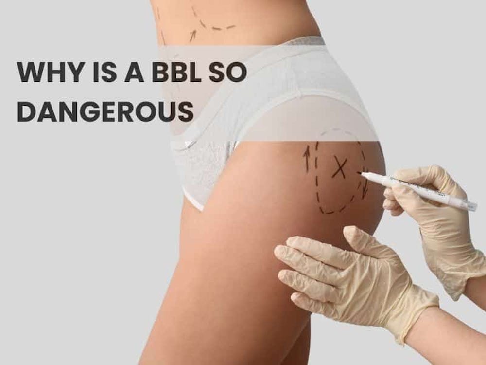 Why is a BBL so dangerous
