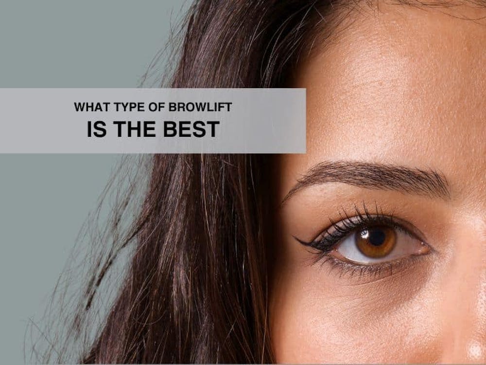 What type of brow lift is best