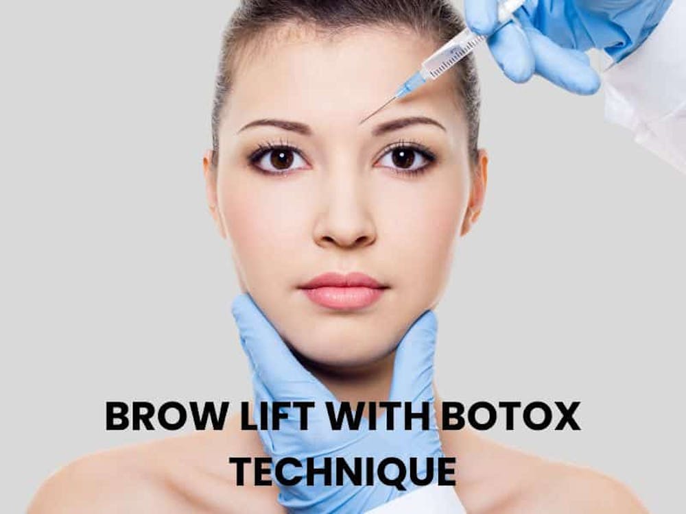 brow lift with botox technique brow lift with botox technique