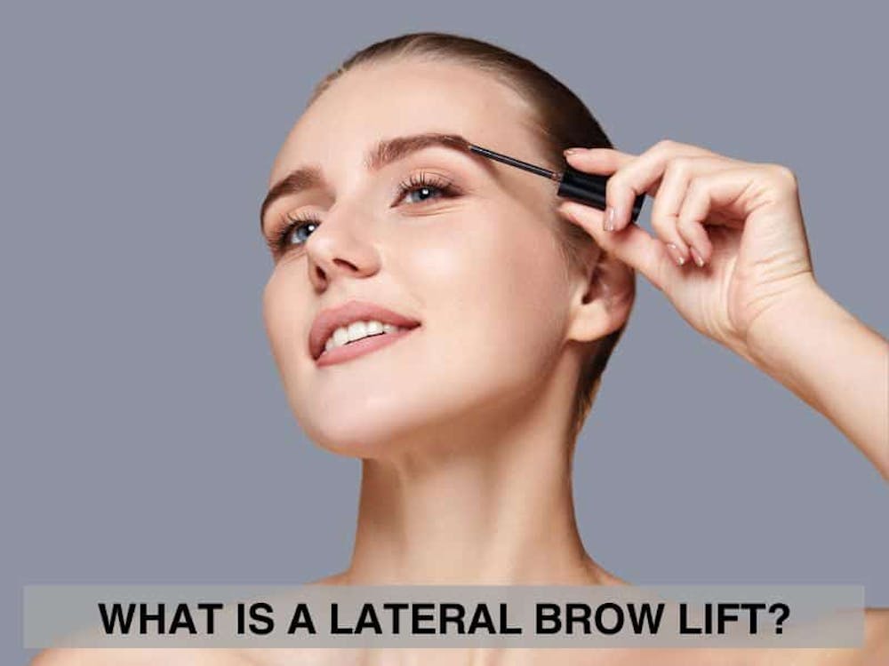 What Is a Lateral Brow Lift What Is a Lateral Brow Lift