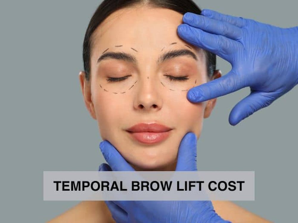 temporal brow lift cost temporal brow lift cost