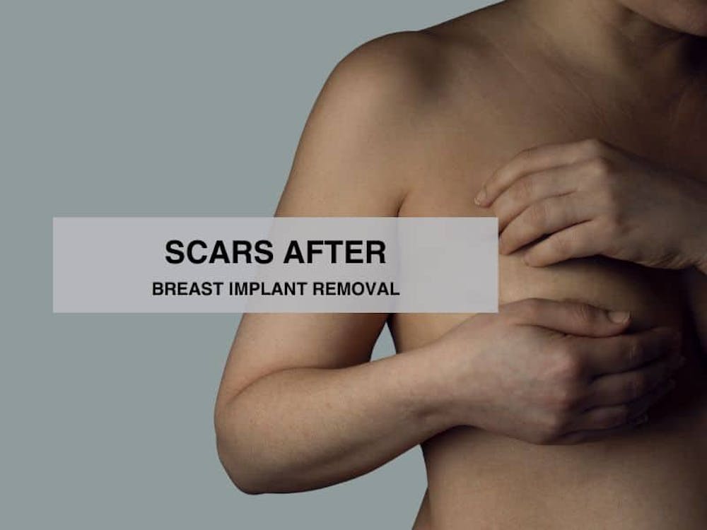 scars after breast implant removal scars after breast implant removal