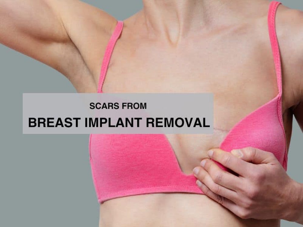 scars from breast implant removal scars from breast implant removal