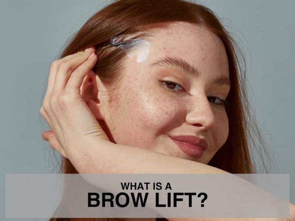 What is a Brow Lift What is a Brow Lift