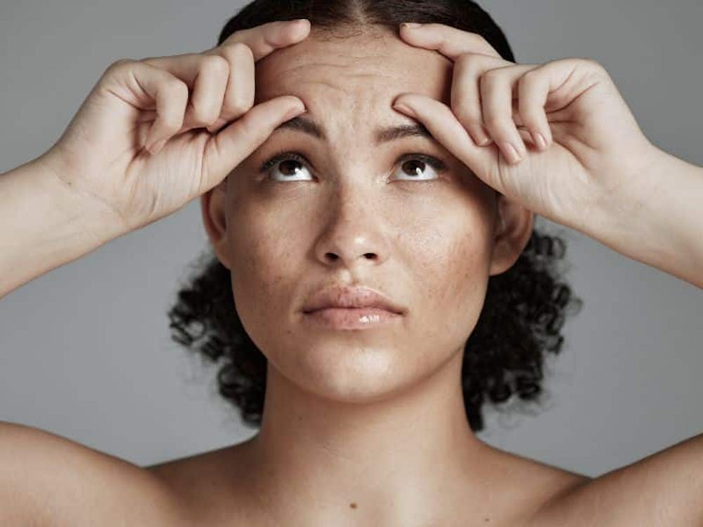 brow lift surgery
