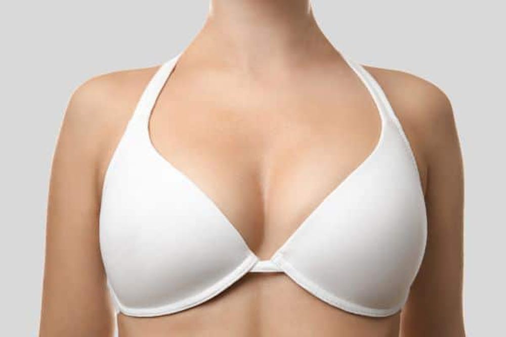 Side effects flat after breast implant removal