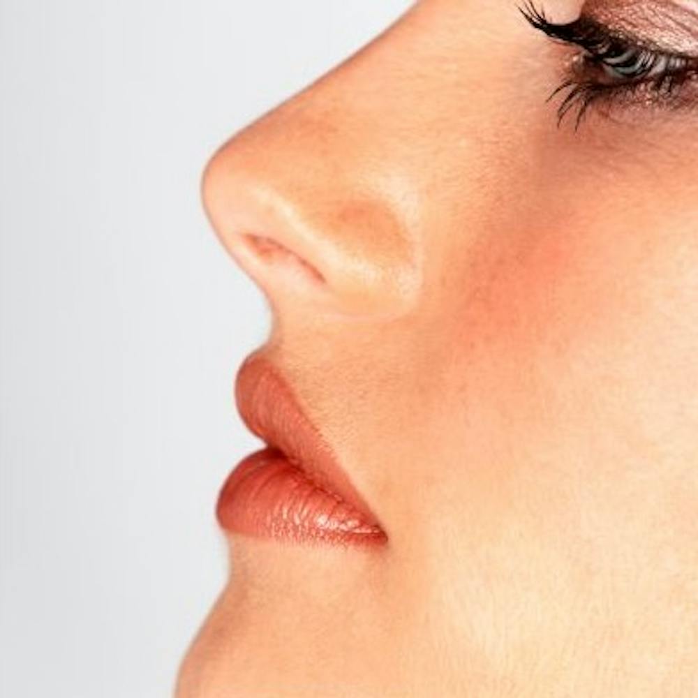 Rhinoplasty Revision Dallas Rhinoplasty Revision Dallas