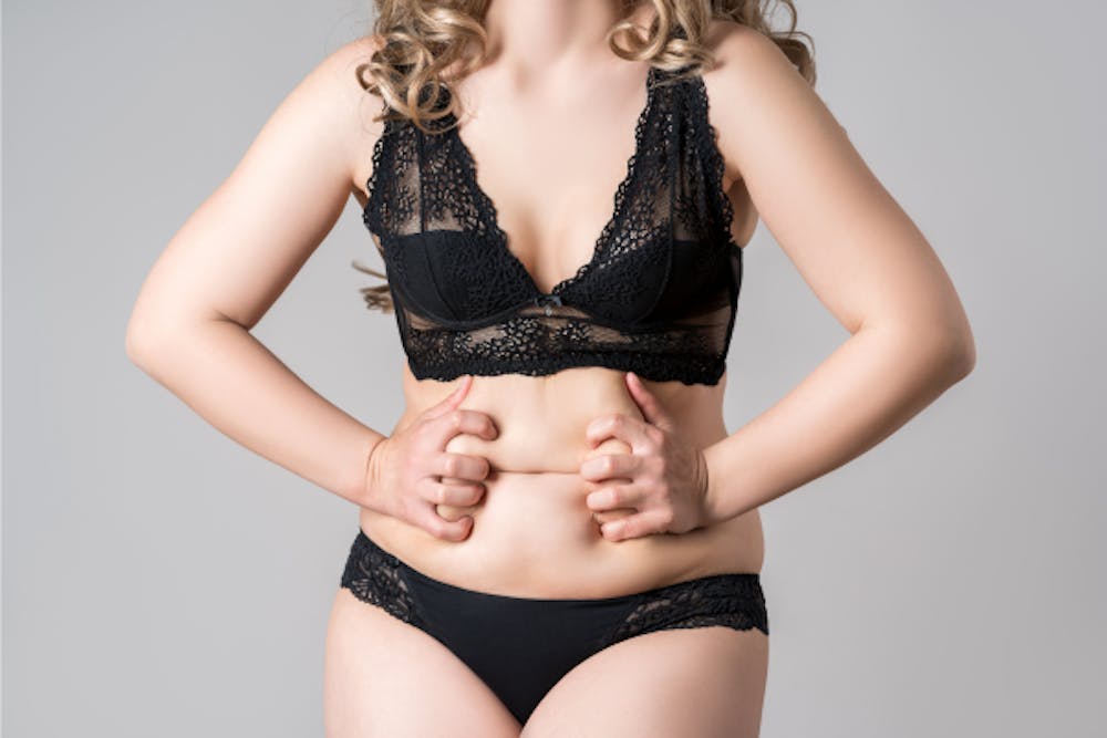 How Much Does A Tummy Tuck Cost