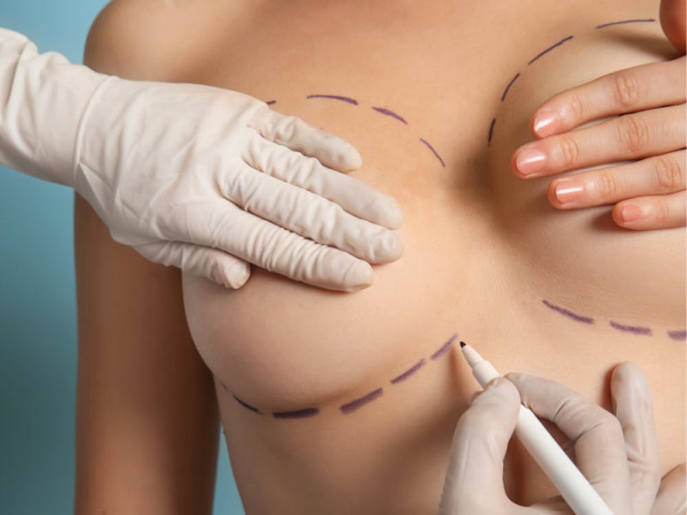 Breast Lift Recovery Time 7 Tips Breast Lift Recovery Time 7 Tips
