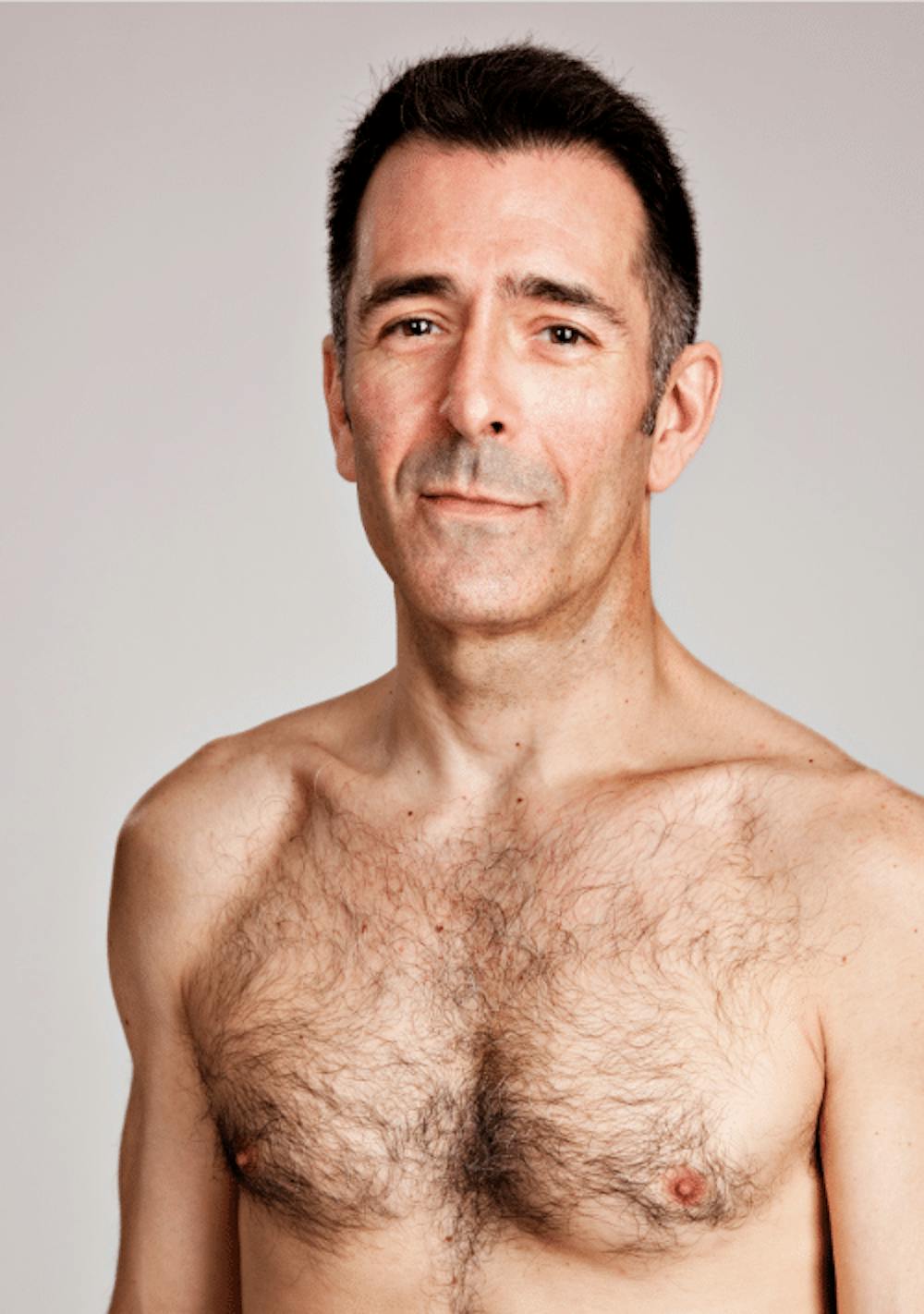 Gynecomastia Surgery Cost