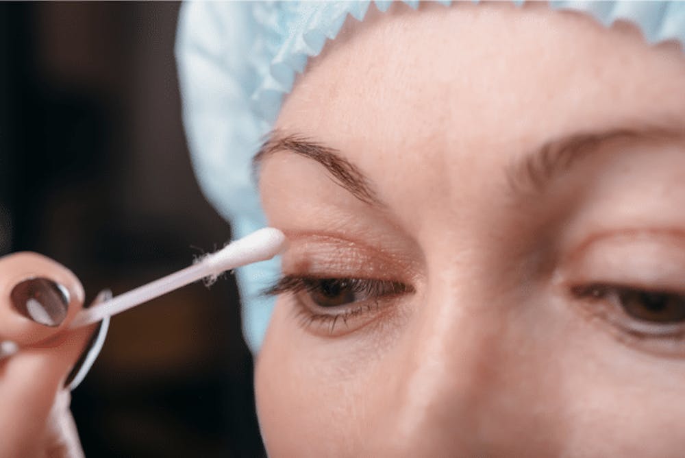 Cost Of Eyelid Surgery