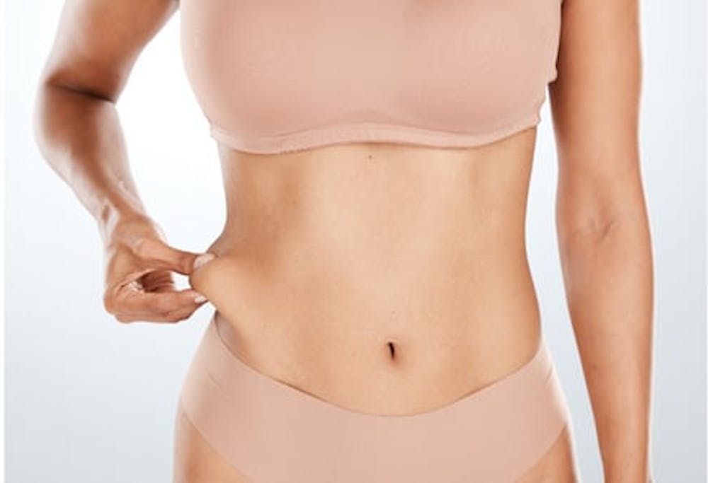 Smart lipo procedure