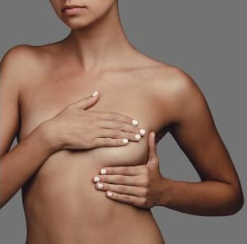 Recovery time for breast implant removal