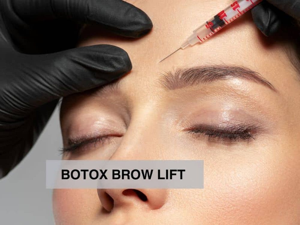 BOTOX BROW LIFT