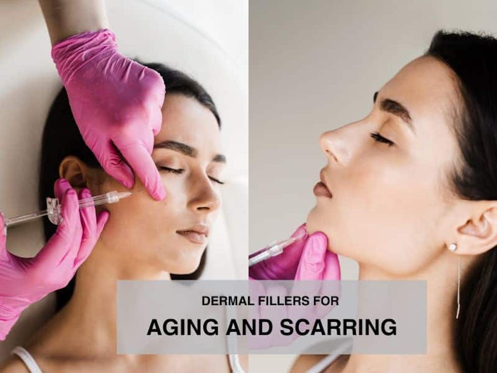 dermal fillers for aging and scarring dermal fillers for aging and scarring