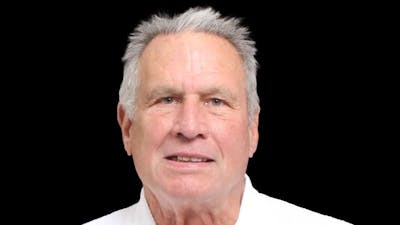 Facelift Before & After Gallery - Patient 392757 - Image 1