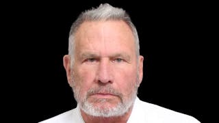 Facelift Before & After Gallery - Patient 392757 - Image 2